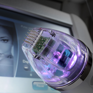 RF-Needling - das Upgrade fürs klassische Microneedling