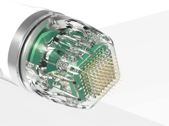 Realistische Erwartung von RF-Needling bei Aknenarben