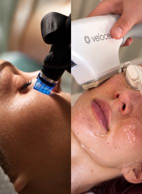 Hydrafacial und Veloce IPDL Laser Behandlung bei D DERMA Aesthetics in Berlin