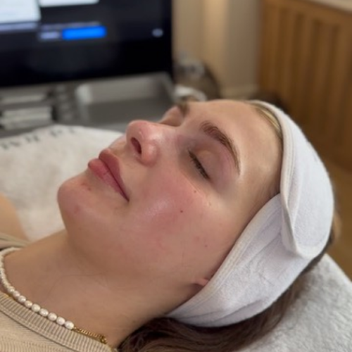 Welche Ergebnisse bringen moderne Peelings