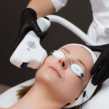 Photorejuvenation mit IPDL