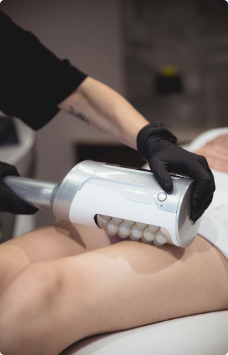 Cellulite Signature Behandlung