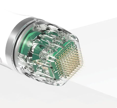 Realistische Erwartung von RF-Needling bei Aknenarben