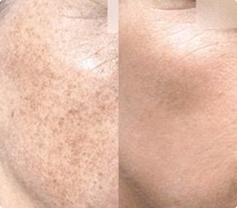 Warum ist IDPL so beliebt?