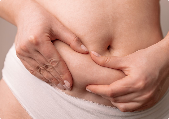 RF-Needling am Bauch – wenn nach Schwangerschaft oder Abnehmen Haut übrig bleibt