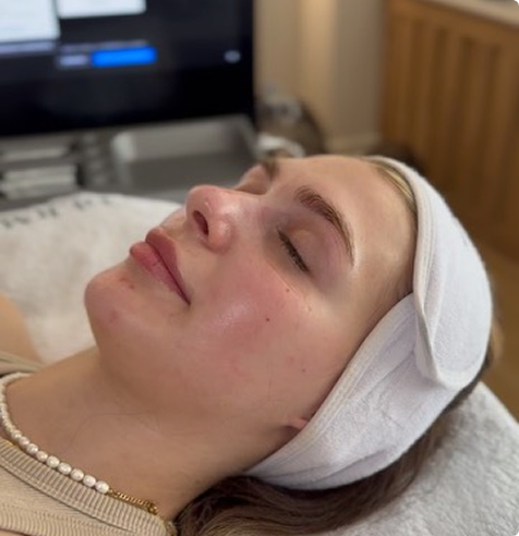 Welche Ergebnisse bringen moderne Peelings