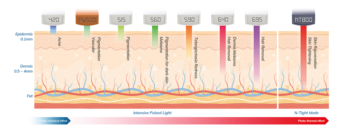 IDP ist die neue Generation der Photorejuvenation
