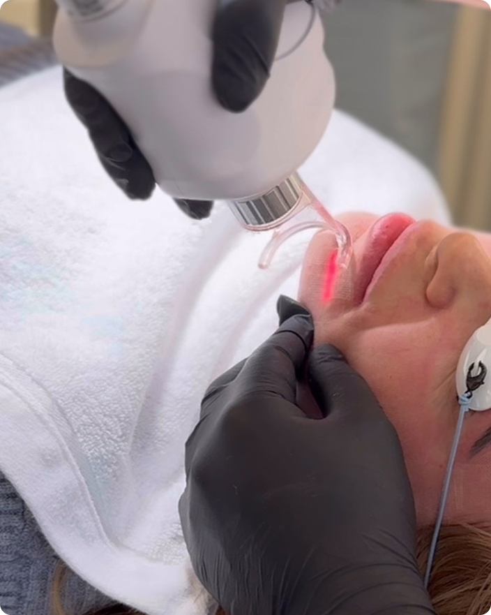 PRP & Co2 Laser in Berlin