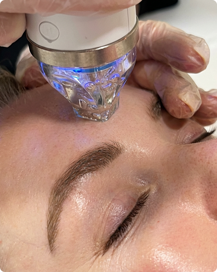 PRP & Co2 Laser in Berlin