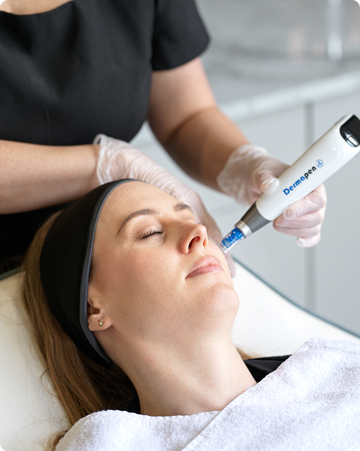 Dermapen Microneedling in Berlin