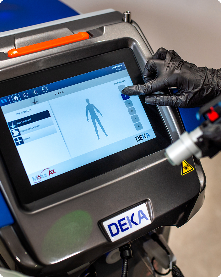 Haarentfernung mit Deka Alexandrit Laser