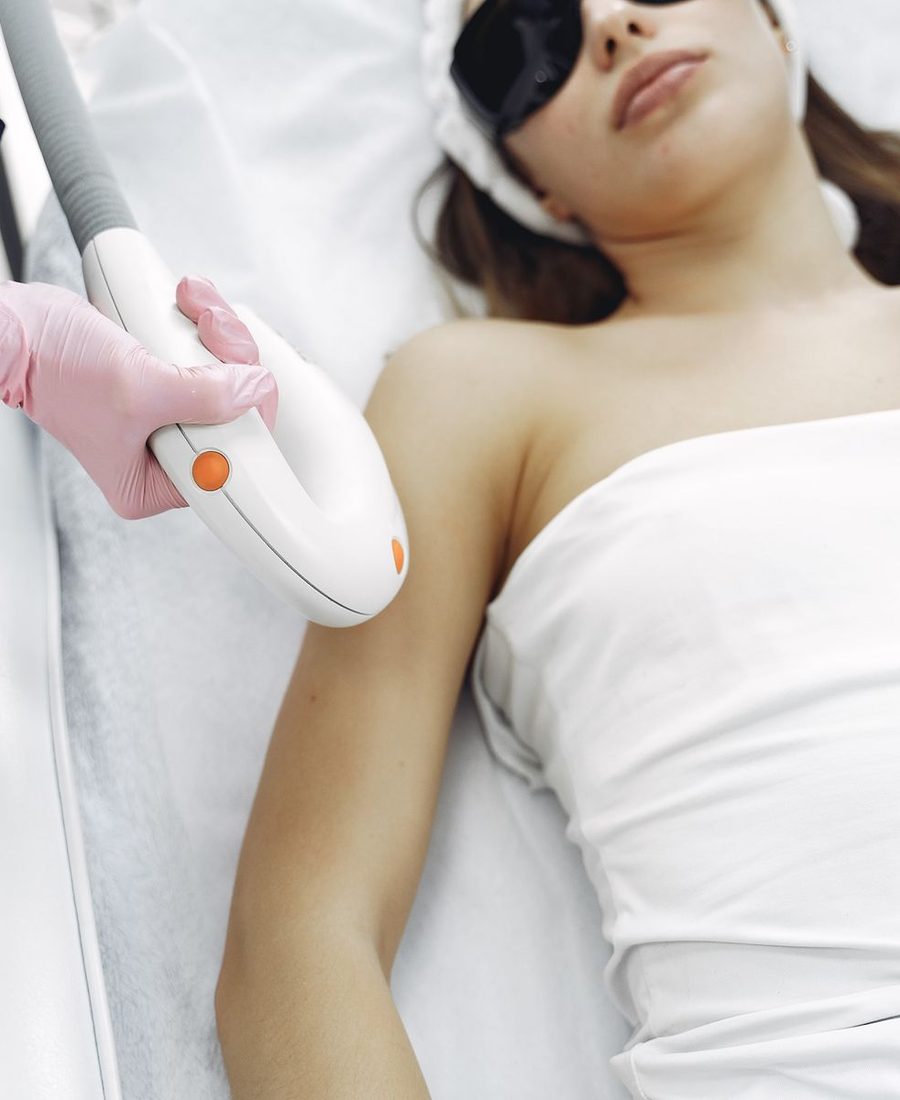 Haarentfernung mit dem Deka Alexandrit Laser bei D DERMA Aesthetics in Berlin
