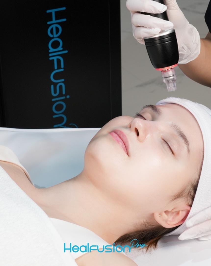 HealFusion Pro Behandlung in Berlin bei D DERMA Aesthetics