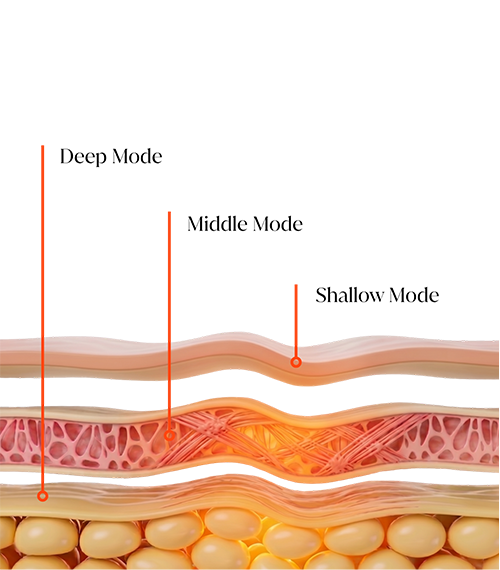 XERF Tiefenmodi: Shallow, Middle und Deep Mode in den Hautschichten